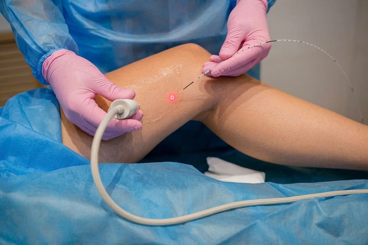 Microcirurgia e Cirurgia de Varizes