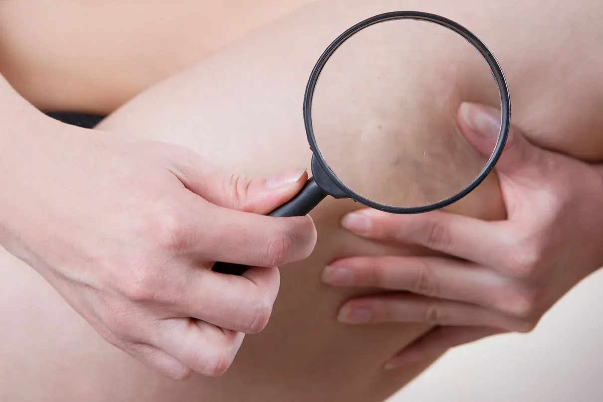 A importância do check-up vascular