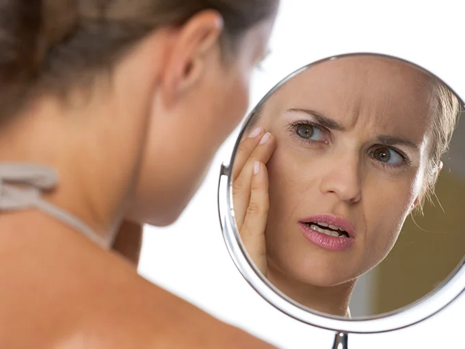 Vasinhos no rosto — o que são as telangiectasias faciais